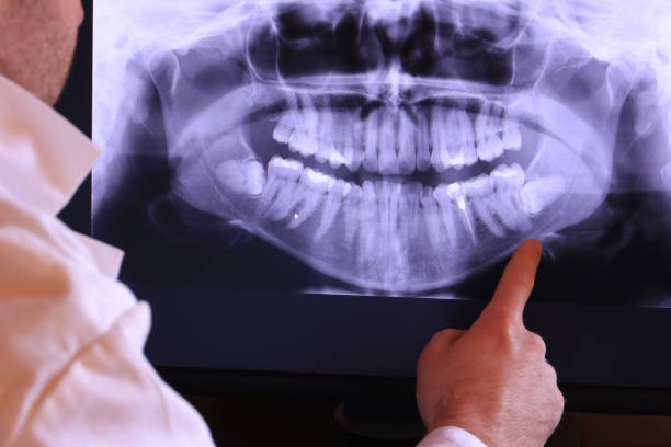 Best Dental Abscess Treatment in Vallejo, CA
